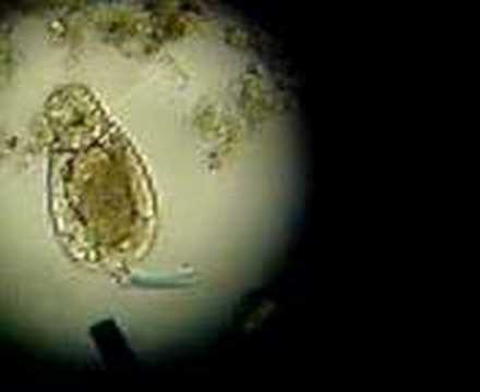 Protozoa