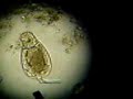 Protozoa Protozoa