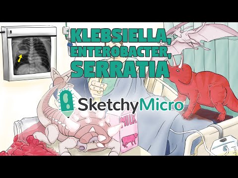 how to treat klebsiella uti