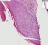 Histopathology-Skin-