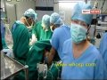 World's First Awake Cardiac Bypass & Valve Surgery, India