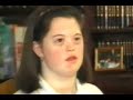 Down syndrome:&nbsp;S�ndrome de Down: Interpretaci�n de �rgano