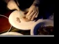 Surgical operation