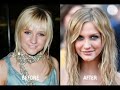 i did the research, and all these people have definitely gotten nose jobs.  some small touch ups, some huge reconstruction.  

pretty much every celebrity ends up getting a nose job... it sucks because sometimes they were really pretty before.  for example, did you ever ask yourself why leelee sobieski doesn't get any more (good) work and why she isn't as pretty as she used to be?  it's because she had a cool looking nose and she made it smaller!