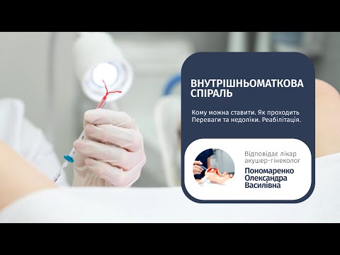 Внутриматочная спираль – все о процедуре