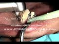 Comprehensive Implant Dentistry Live Training Courses at MiamiImplantsLive.com