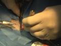 Neuticles Instructional Video