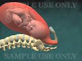 3D Medizinische Animation: Normal Vaginal Geburt mit der Halswirbelsäule Auslöschung und Erweiterung (Dilatation)