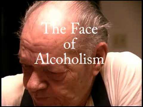 Face of Alcoholism