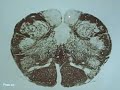Lower Medulla (Sensory decussation)