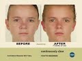 Continuously-Clear-A