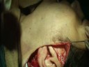 Face-Lift F. Alkhairy Cosmetic Surgery Centre Karachi Face-Lift F. Alkhairy Cosmetic Surgery Centre Karachi