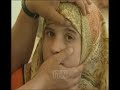 طفلة لبنانية عمرها لا يتجاوز الـ 12 عاما حيرت الأطباء. حالتها غريبة عجيبة حيث أن عينيها تذرف الزجاج أو مادة شبيهة بالكريستال الصلب والحاد جدا دون أن تؤذيها. نيو نيوز.