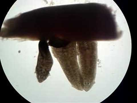 Three Planaria Feeding on Liver