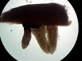 Three Planaria Feeding on Liver Three Planaria Feeding on Liver
