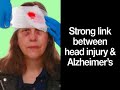 Understanding Alzheimer's Disease (Alzheimers #1)