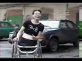 amputee rimma 3
