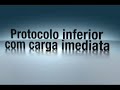 08   protocolo inferior com carga imediata clínica cir