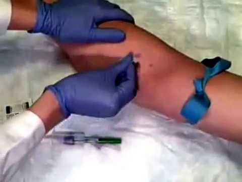 how to collect blood by venipuncture