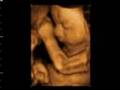 4D baby scan of Allison and Robert