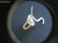 Ascaris lumbricoides
