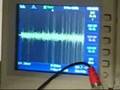 videos de rat inferior olivary neurons