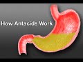 Easing Heartburn (Health Short)