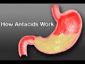Easing Heartburn (Health Short)
