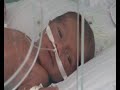 MaximsNewsNetwork: PREMATURE BIRTHS & DEATHS, INEQUALITIES WORLDWIDE (W.H.O.) (UNTV)