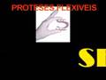 PRÓTESES FLEXÍVEIS DEFLEX