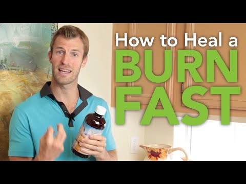 how to treat oil burns