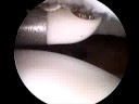 Knee Scope