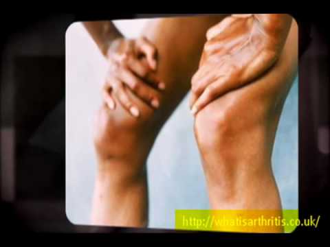how to relieve juvenile arthritis pain