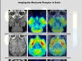 exposing the myth of smoked medical marijuana / anti marijuana psa video