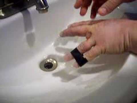 how to treat a whitlow nhs