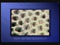 Blanqueamiento Dental Blanqueamiento Dental