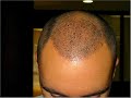 Dr Bisanga - BHR Clinic Dr Bisanga - BHR Clinic