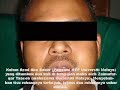 Hasutan dan Provokasi GMM