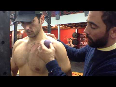 clavicular - See the full post and find additional information at www.thewoddoc.com www.thewoddoc.com.