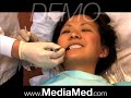 Tooth-Colored Fillings-Composite Fillings-Dental
