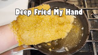 Deep Frying My Own Hand