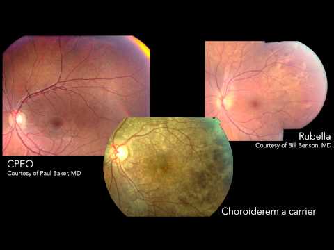 how to treat uveitis in cats