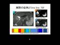 EOBプリモビストMRI 撮像方法と実際の画像