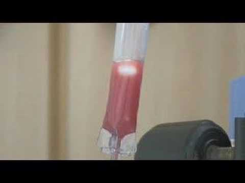 how to extract bone marrow for transplant