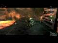 videos de zelda pinky