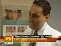 Laser Hair Removal on NBC\