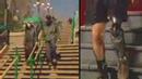 Prostheses & Prosthetics Rehab