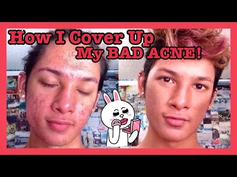 My Unique Makeup Foundation Routine for Bad Acne