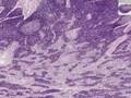 Histología - Ganglio linfático