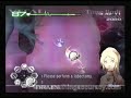 Second Opinion 3.4 XS Guide